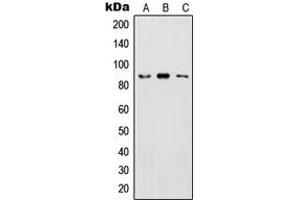 Western blot analysis of IKK beta (pY199) expression in HeLa LPS-treated (A), Raw264. (IKBKB anticorps  (pTyr199))