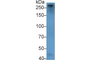 Detection of F5 in Rat Plasma using Polyclonal Antibody to Coagulation Factor V (F5) (Coagulation Factor V anticorps  (AA 1944-2099))