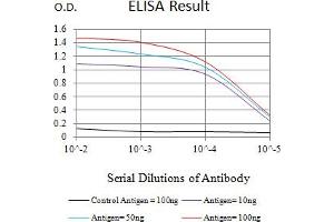 Black line: Control Antigen (100 ng),Purple line: Antigen (10 ng), Blue line: Antigen (50 ng), Red line:Antigen (100 ng)