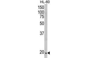 Western blot analysis of NDUFS4 Antibody (C-term) in HL-60 cell line lysates (35ug/lane). (NDUFS4 anticorps  (C-Term))