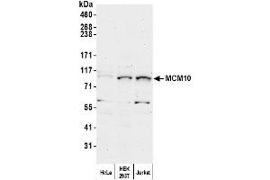 Western Blotting (WB) image for anti-Minichromosome Maintenance Deficient 10 (MCM10) (AA 600-650) antibody (ABIN7449575)