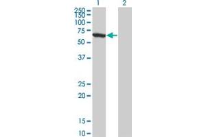 Western Blot analysis of WDR20 expression in transfected 293T cell line by WDR20 monoclonal antibody (M01), clone 1D10. (WDR20 anticorps  (AA 1-569))