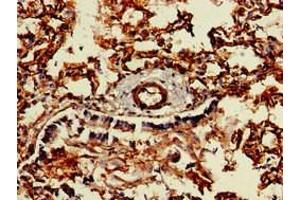 Immunohistochemistry of paraffin-embedded human lung tissue using ABIN7147067 at dilution of 1:100