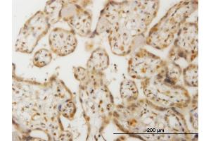 Immunoperoxidase of monoclonal antibody to CHEK2 on formalin-fixed paraffin-embedded human placenta. (CHEK2 anticorps  (AA 1-543))