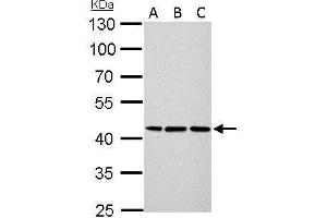 WB Image Cytokeratin 14 antibody detects KRT14 protein by Western blot analysis. (KRT14 anticorps)