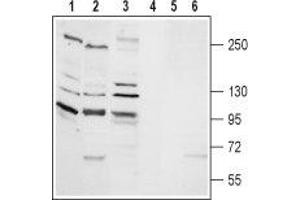 Western blot analysis of rat lung membrane (lanes 1 and 4), rat brain membrane (lanes 2 and 5) and human K562 chronic myelogeneous cells (lanes 3 and 6) lysates: - 1-3. (TRPM2 anticorps  (Intracellular, N-Term))