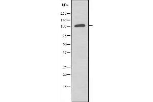 Western blot analysis of extracts from COLO205 cells, using ST5 antibody. (ST5 anticorps  (Internal Region))