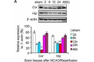 Nurr1 expression at 2, 6, 12, 24 and 48 h after MCAO/R. (beta Actin anticorps)