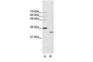 Image no. 1 for anti-ATPase, Cu++ Transporting, alpha Polypeptide (ATP7A) (C-Term) antibody (ABIN203040) (ATP7A anticorps  (C-Term))