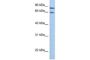 WB Suggested Anti-PPP1R10 Antibody Titration:  0. (PPP1R10 anticorps  (N-Term))