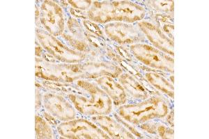 Immunohistochemistry of paraffin-embedded rat kidney using GPS1 Rabbit pAb (ABIN6127934, ABIN6141361, ABIN6141362 and ABIN6222653) at dilution of 1:250 (40x lens). (GPS1 anticorps  (AA 258-527))