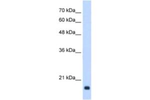 Western Blotting (WB) image for anti-Growth Arrest and DNA-Damage-Inducible, beta (GADD45B) antibody (ABIN2463174) (GADD45B anticorps)