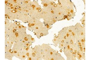 Lck Mouse Monoclonal Antibody at 1/100 staining rat brain tissue by IHC-P.