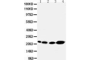 Anti-Caveolin-2 antibody, Western blotting Lane 1: Rat Heart Tissue Lysate Lane 2: Rat lung Tissue Lysate Lane 3: HELA Cell Lysate Lane 4: A431 Cell Lysate (Caveolin 2 anticorps  (N-Term))