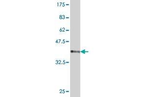 Western Blot detection against Immunogen (37.