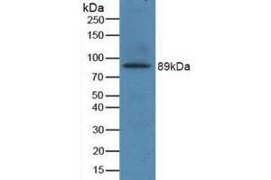 Detection of Recombinant GRIN2B, Human using Polyclonal Antibody to Glutamate Receptor, Ionotropic, N-Methyl-D-Aspartate 2B (GRIN2B) (GRIN2B anticorps  (AA 35-557))
