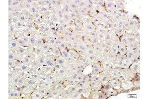 Formalin-fixed and paraffin embedded rat liver labeled with Anti-CD209 Polyclonal Antibody, Unconjugated (ABIN678893) at 1:200 followed by conjugation to the secondary antibody and DAB staining (DC-SIGN/CD209 anticorps  (AA 81-180))