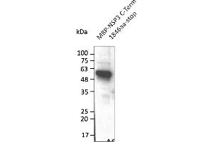 Western Blotting (WB) image for anti-SARS-CoV-2 Papain-Like Protease (NSP3) (C-Term) antibody (ABIN7272998) (SARS-CoV-2 NSP3 anticorps  (C-Term))