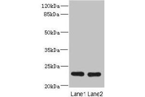 Western blot All lanes: RAB17 antibody at 3. (RAB17 anticorps  (AA 1-212))