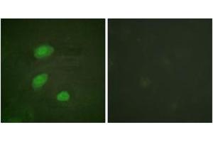 Immunofluorescence analysis of HeLa cells, using HIRA (Phospho-Thr555) Antibody. (HIRA anticorps  (pThr555))