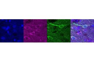 Immunohistochemistry (IHC) image for anti-Ubiquitin Carboxyl-terminal Esterase L1 (Ubiquitin Thiolesterase) (UCHL1) antibody (ABIN7456137) (UCHL1 anticorps)