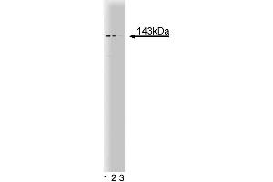 Western blot analysis of PEX1 on a HCT-8 cell lysate (Human colorectal adenocarcinoma, ATCC CCL-244). (PEX1 anticorps  (AA 1049-1256))