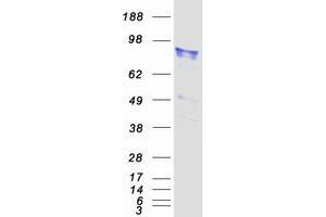 Validation with Western Blot