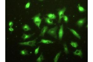 Detection of F13A1 in A549 cells using Polyclonal Antibody to Coagulation Factor XIII A1 Polypeptide (F13A1)