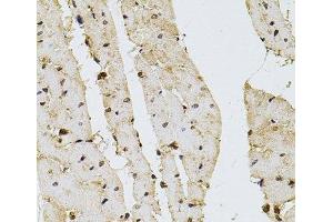 Immunohistochemistry of paraffin-embedded Rat heart using PPP2R5C Polyclonal Antibody at dilution of 1:100 (40x lens). (PPP2R5C anticorps)