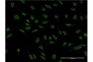 Immunofluorescence of monoclonal antibody to BCL11A on HeLa cell.