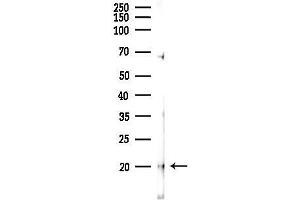 Western blot analysis of lysates from Mouse lung, using MYLPF Antibody at 1/1000 dilution.