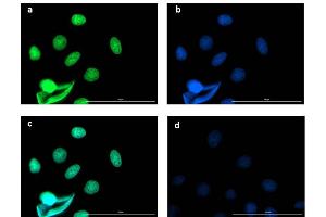 Immunofluorescence microscopy using Fluorescent anti-rabbit IgG Immunofluorescence microscopy of BCL3 in Caco-2 cells using FITC-conjugated Fluorescent anti-rabbit IgG for detection.