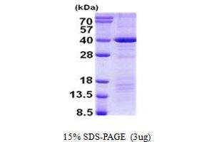 Image no. 1 for Death Effector Domain Containing (DEDD) (AA 1-318) protein (His tag) (ABIN7280134)