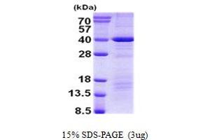 Image no. 1 for Death Effector Domain Containing (DEDD) protein (His tag) (ABIN7280134) (DEDD Protein (His tag))