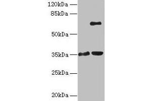 Western blot All lanes: ZNF75A antibody at 10 μg/mL Lane 1: Mouse brain tissue Lane 2: Mouse liver tissue Secondary Goat polyclonal to rabbit IgG at 1/10000 dilution Predicted band size: 35 kDa Observed band size: 35, 65 kDa (ZNF75A anticorps  (AA 1-296))
