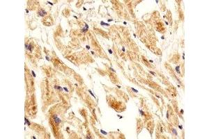 IHC analysis of FFPE human heart section using Integrin beta 8 antibody; Ab was diluted at 1:25.