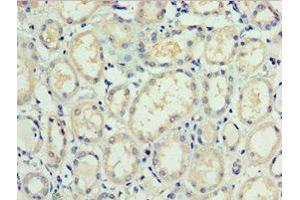 Immunohistochemistry of paraffin-embedded human kidney tissue using ABIN7171561 at dilution of 1:100 (TAF1C anticorps  (AA 70-320))
