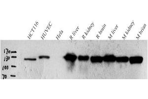Western Blot analysis of various samples using N-cadherin Polyclonal Antibody at dilution of 1:1000. (N-Cadherin anticorps)