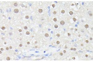 Immunohistochemistry of paraffin-embedded Rat liver using MLF2 Polyclonal Antibody at dilution of 1:100 (40x lens). (MLF2 anticorps)
