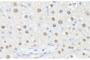 Immunohistochemistry of paraffin-embedded Rat liver using MLF2 Polyclonal Antibody at dilution of 1:100 (40x lens). (MLF2 anticorps)