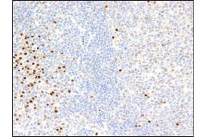 Immunohistochemistry using PIM2 mAb.