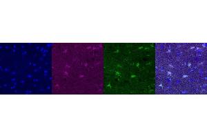 Immunohistochemistry (IHC) image for anti-Glutamate-Ammonia Ligase (GLUL) antibody (ABIN7456060) (GLUL anticorps)