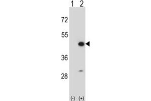 Western Blotting (WB) image for anti-Creatine Kinase, Mitochondrial 2 (Sarcomeric) (CKMT2) antibody (ABIN3002971) (CKMT2 anticorps)