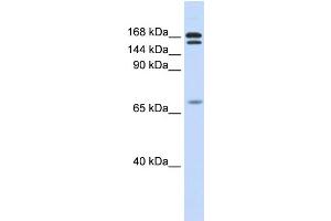 WB Suggested Anti-CUX2 Antibody Titration:  0. (CUX2 anticorps  (N-Term))