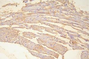 IHC analysis of Hsp20 using anti-Hsp20 antibody (ABIN5518920). (HSPB6 anticorps  (AA 73-123))
