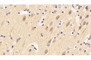 Detection of NRN1 in Porcine Cerebrum Tissue using Polyclonal Antibody to Neuritin 1 (NRN1) (NRN1 anticorps  (AA 28-142))