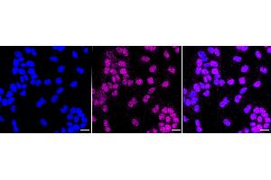 anti-Excision Repair Cross-Complementing Rodent Repair Deficiency, Complementation Group 8 (ERCC8) antibody