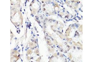 Immunohistochemistry of paraffin-embedded Human stomach using TBX20 Polyclonal Antibody at dilution of 1:100 (40x lens).