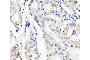 Immunohistochemistry of paraffin-embedded Human stomach using TBX20 Polyclonal Antibody at dilution of 1:100 (40x lens). (TBX20 anticorps)