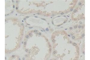 Detection of ABI1 in Human Kidney Tissue using Polyclonal Antibody to Abl Interactor 1 (ABI1)